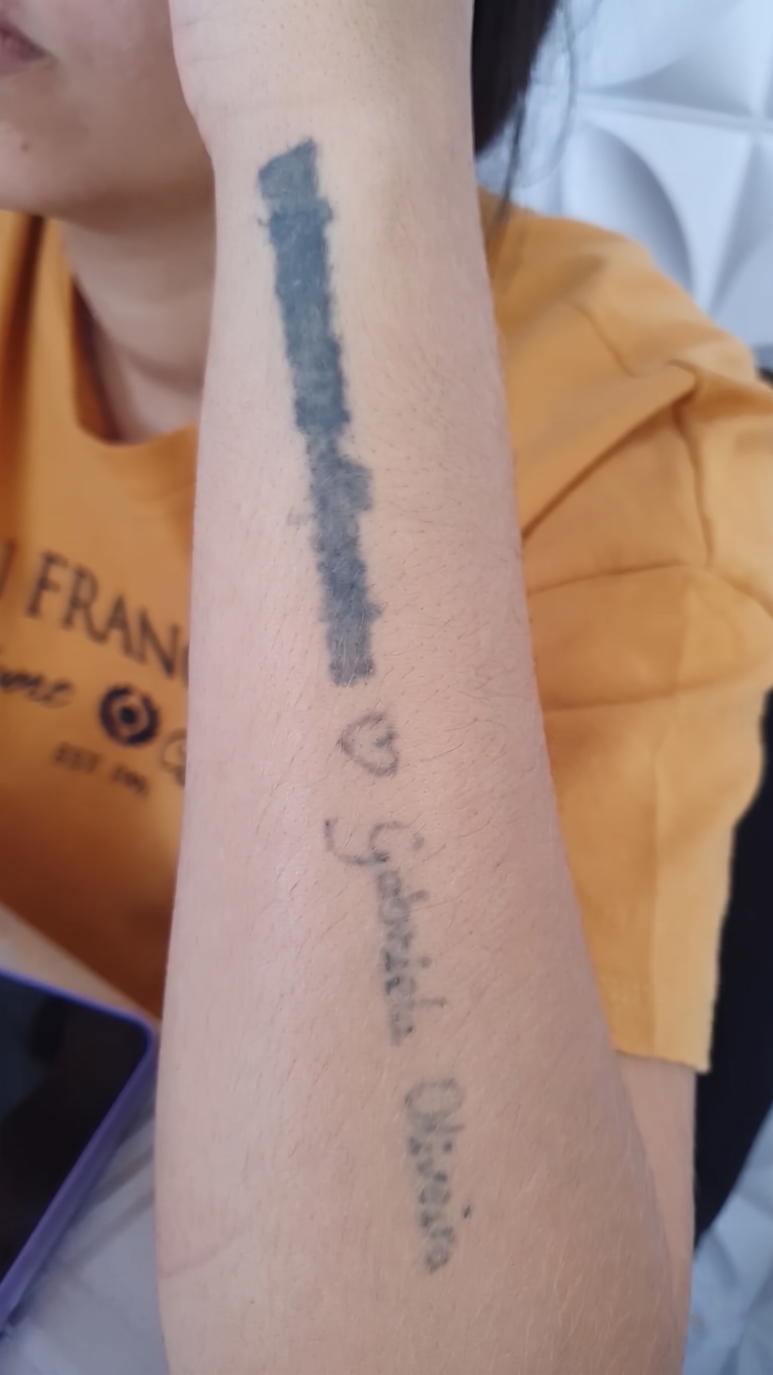 Antes — Tatuagem original